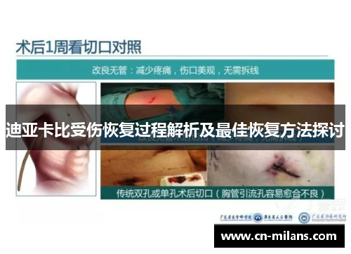 迪亚卡比受伤恢复过程解析及最佳恢复方法探讨
